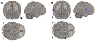 Brain Structure and Function in Women with Comorbid Bipolar and Premenstrual Dysphoric Disorder